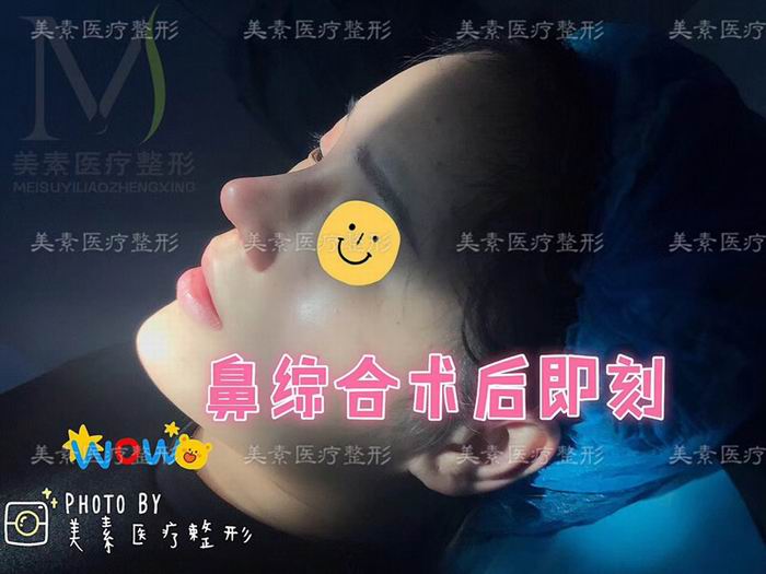 郑州自体脂肪隆胸→郑州做下巴哪家专业 
