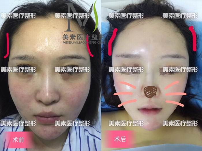 郑州整形医院哪家好→郑州整形医院哪家专业 