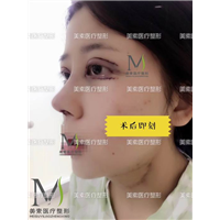 美素医疗整形医院→郑州网红整形 