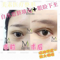 郑州整形医院哪家好→郑州整形医院哪家专业 