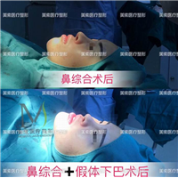 郑州网红整形→郑州美素整形 