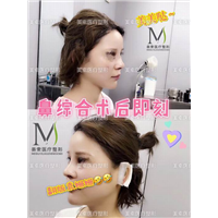 郑州做下巴哪家专业→郑州做抽脂哪家好 