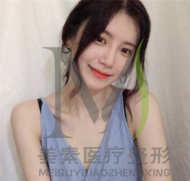 河南整形医院哪家专业 