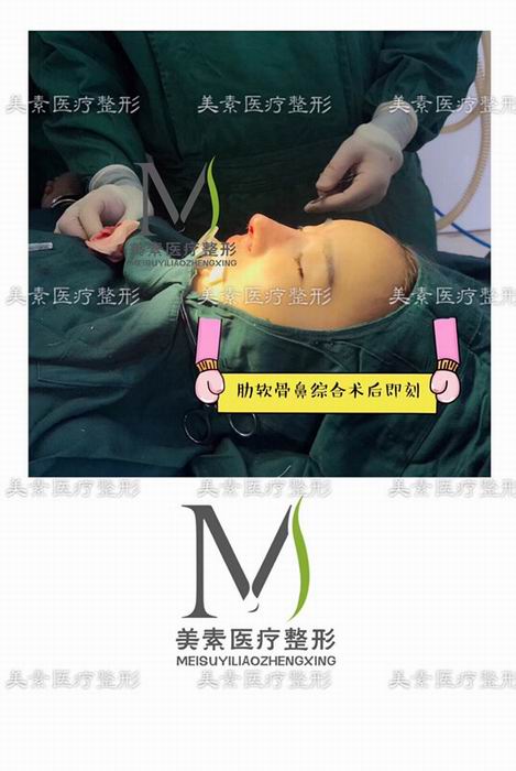 郑州美素整形医院→郑州整形医院哪家好 