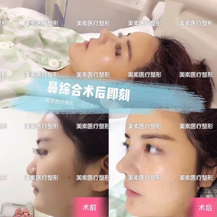 郑州美素整形医院→郑州整形医院哪家好 