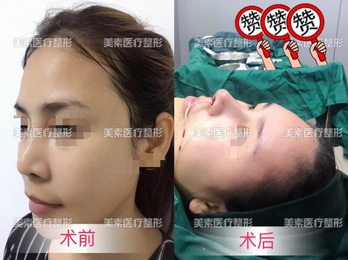 郑州网红整形→郑州美素整形 