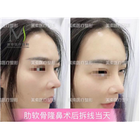 郑州整形医院哪家好→郑州整形医院哪家专业 
