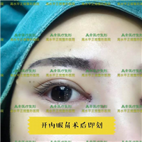 郑州整形医院哪家专业→郑州鼻综合整形 