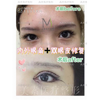 郑州美素整形医院 