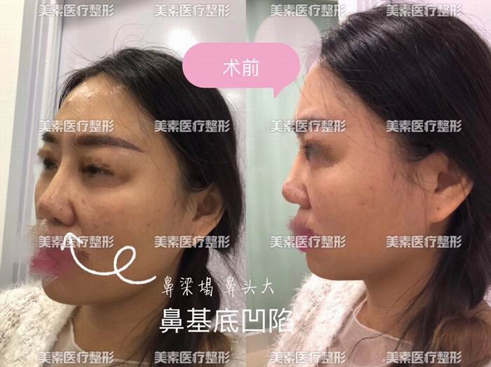 郑州整形医院哪家好→郑州整形医院哪家专业 