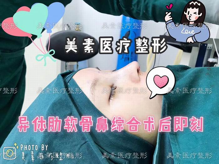 郑州美素整形医院→郑州整形医院哪家好 