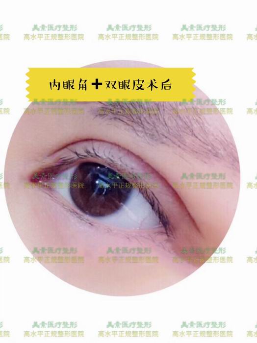 郑州整形医院哪家专业 