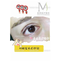 郑州整形医院哪家好 