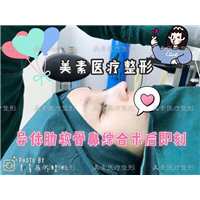 郑州美素整形医院→郑州整形医院哪家好 