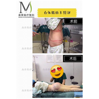 前后对比 