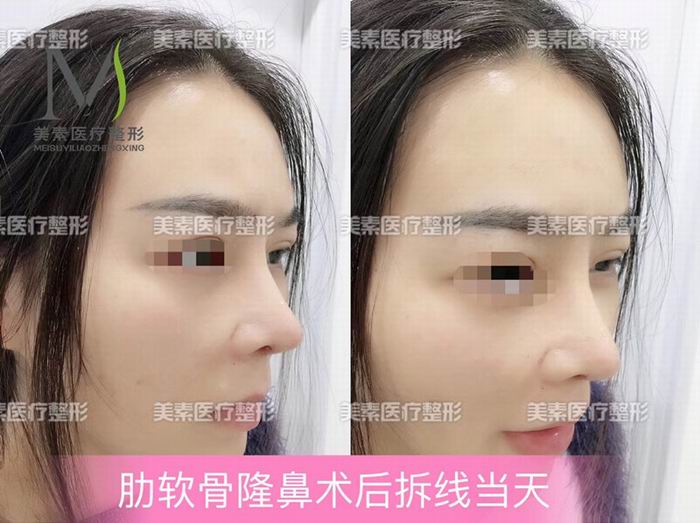 郑州整形医院哪家好→郑州整形医院哪家专业 