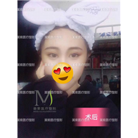 郑州眼综合整形、郑州眼综合整形哪家好 