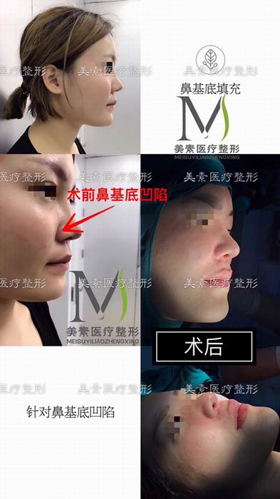郑州美素整形医院→郑州整形医院哪家好 