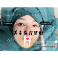 郑州美素整形医院→郑州整形医院哪家好 