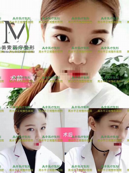 郑州整形医院哪家好→郑州整形医院哪家专业 