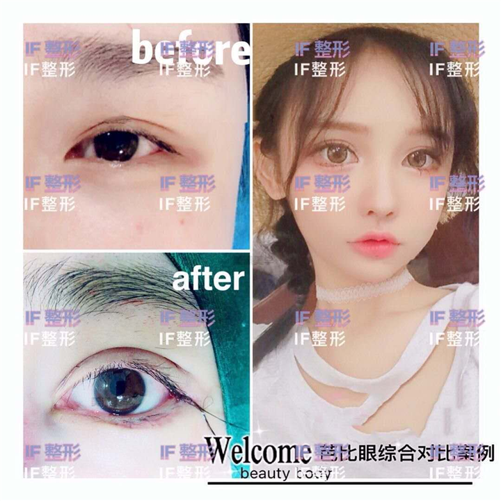 厦门网红整形|厦门网红整形医院