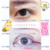 厦门鼻综合整形\厦门网红整形