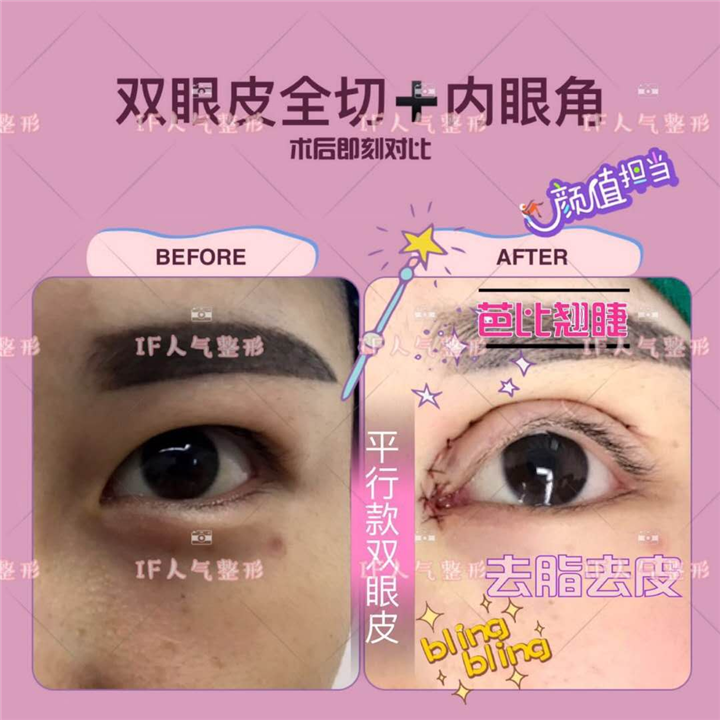 厦门if医疗整形|厦门鼻综合整形