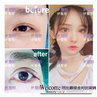 厦门网红整形|厦门网红整形医院