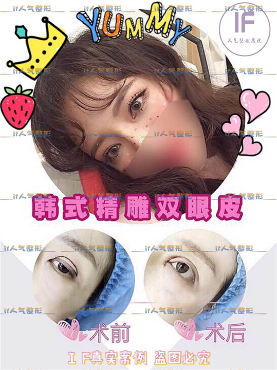 厦门if医疗整形|厦门鼻综合整形