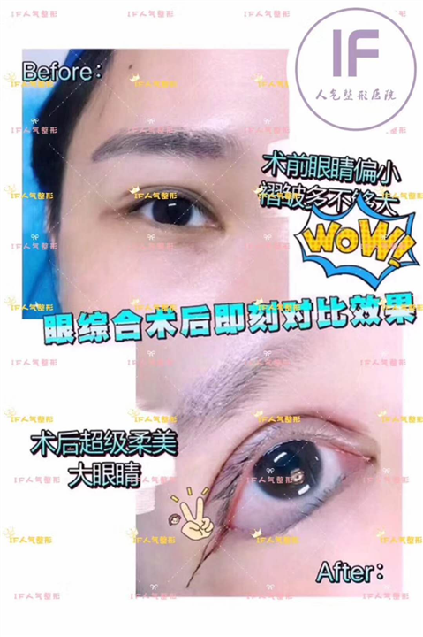 厦门if医疗整形|厦门鼻综合整形