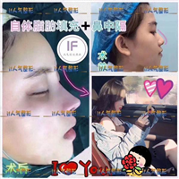 IF整形外科|if整形官网