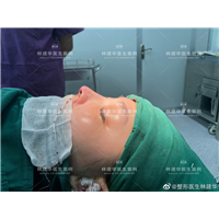 厦门鼻综合整形专家