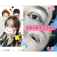 厦门网红整形医院|厦门人气网红整形