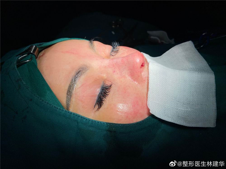 厦门鼻综合整形专家