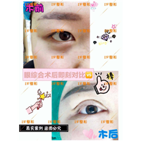 厦门网红整形医院|厦门人气网红整形