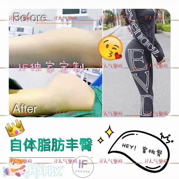 if整形官网|厦门if医疗整形