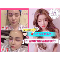 IF整形外科|if整形官网