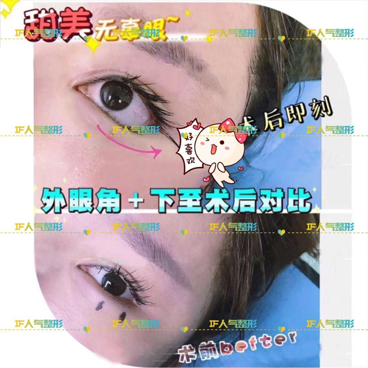 厦门网红整形医院|厦门人气网红整形