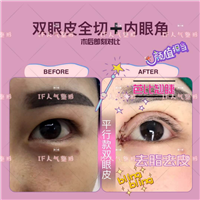 厦门if医疗整形|厦门鼻综合整形