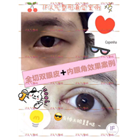 厦门if医疗整形|厦门鼻综合整形
