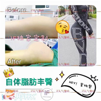 if整形官网|厦门if医疗整形