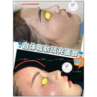 IF整形外科|if整形官网