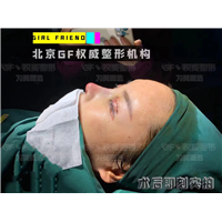 北京刘军整形医生