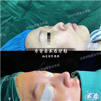 北京鼻修复好的专家