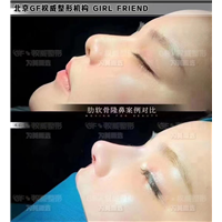 北京鼻部整形医生