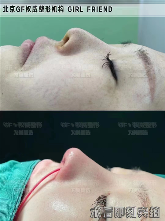 北京鼻修复专家