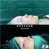 北京修复鼻部整形