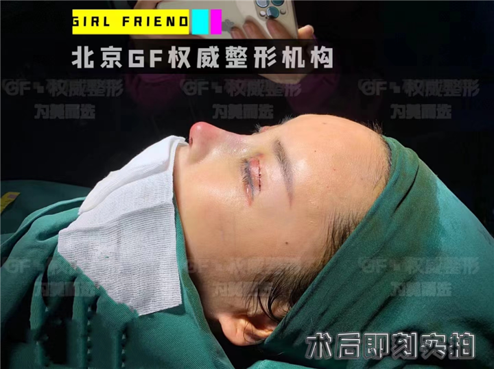北京刘军整形医生