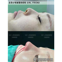 北京鼻修复专家