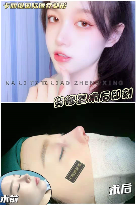 上海鼻综合整形
